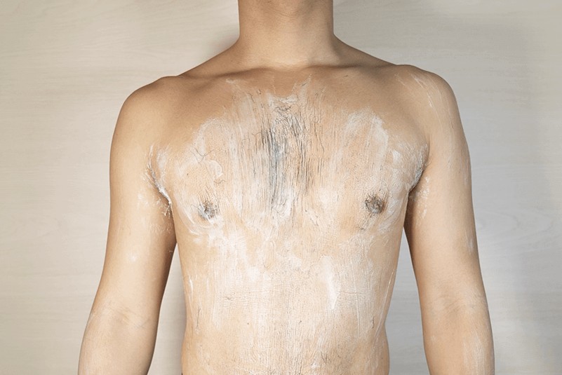 Zリムーバー使用時は乳輪周りは短時間 or テープの使用がおすすめ