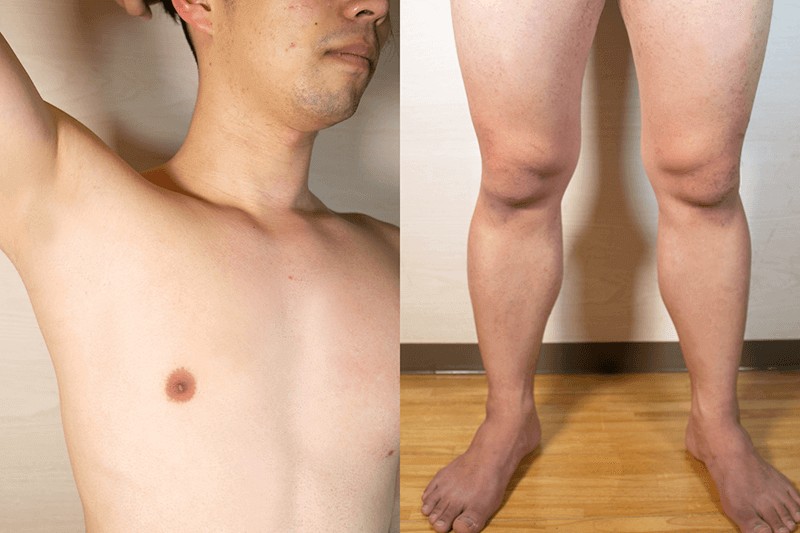 除毛クリーム「Zリムーバー」検証:除毛後はしっかり保湿ケアを