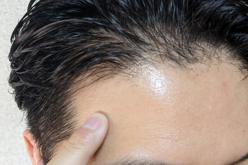 ファーサを実際に使ったからわかる注意点:髪が塗れた状態だとスキャルプパッチが溶けてしまうので必ず乾かしてから使用する。